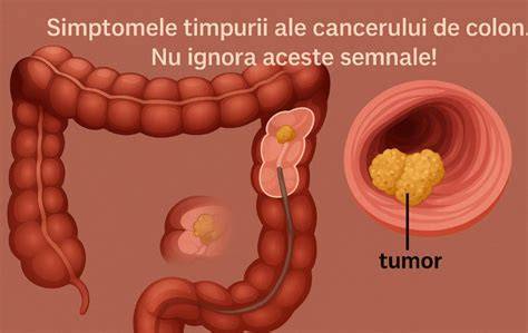 Infografice despre semnele timpurii ale sarcinii: implantare, simptome comune, testare