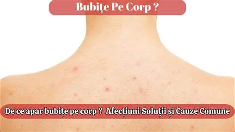 Tipuri de bubite pe piele