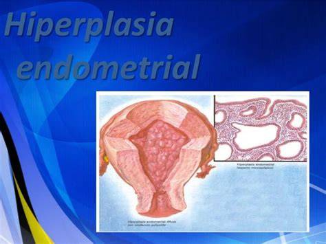 Hiperplazia endometriala si posibilele manifestari clinice