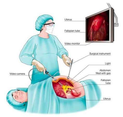 O diagramă a procesului diagnostic: de la anamneză la laparoscopie