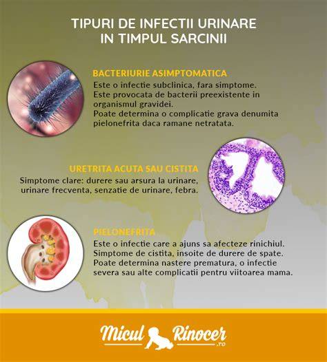 Infografic riscuri si tratament infectii urinare in sarcina