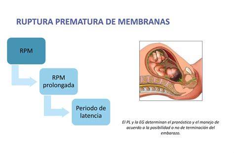 Ruptura prematura de membrane - reprezentare grafica a fluxului de lichid amniotic