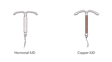 Eficiența și mecanismele steriletelor: infografic cu DIU hormonal vs. Cupru