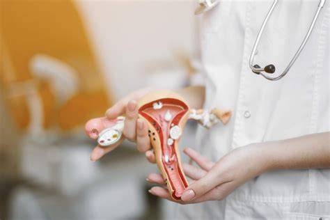 Infografic: opțiuni de contracepție după cezariană (local, transdermal, DIU, inel vaginal)