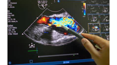 Diagrame: fluxuri arteriale vs. venoase în Doppler