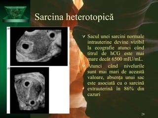 Infografic: etapele diagnosticului în sarcina timpurie (ecografie, hCG, monitorizare)