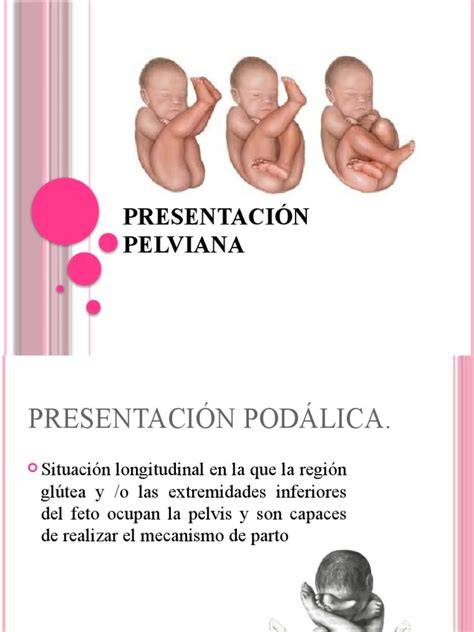 Diagramă: tipuri de prezentatie pelviana