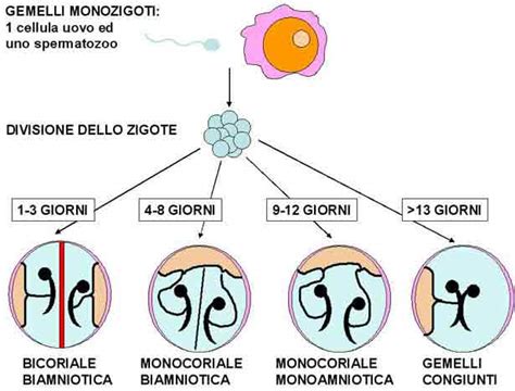 Infografic: Tipuri de sarcină gemelară (monocoriale, bicoriale, diamniotice vs monoamniotice)