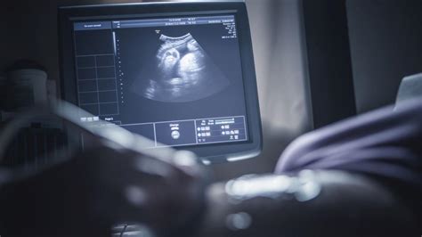 Femeie însărcinată vizionând un ecran de calculator