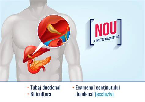 Infografic: rolul uroculturii în diagnosticarea ITU în sarcină