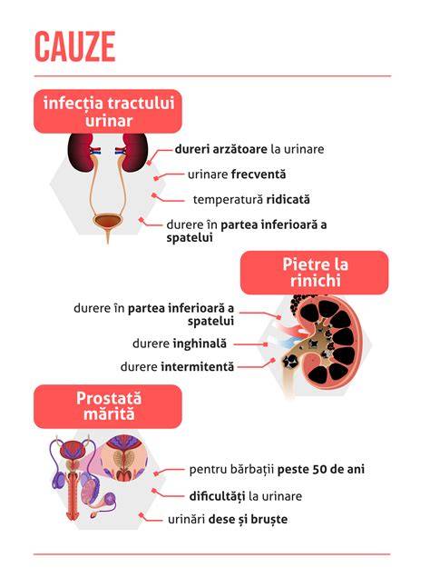 Infografic: Hematurie - tipuri, cauze și pași ai diagnosticului