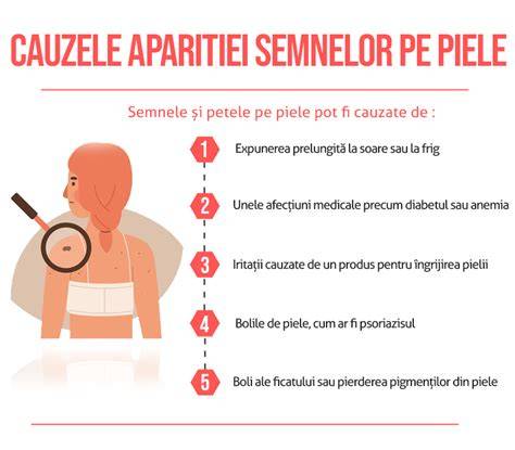 Rolul contactului piela pe piele și alăptarea imediat după cezariană
