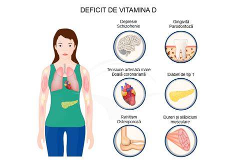 Grafic: efectele deficitului de vitamina D asupra sarcinii și copilului
