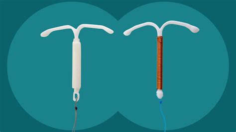 Tipuri de dispozitive intrauterine (DIU)
