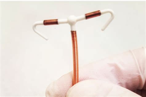 Tipuri de sterilet: hormonal și cu cupru