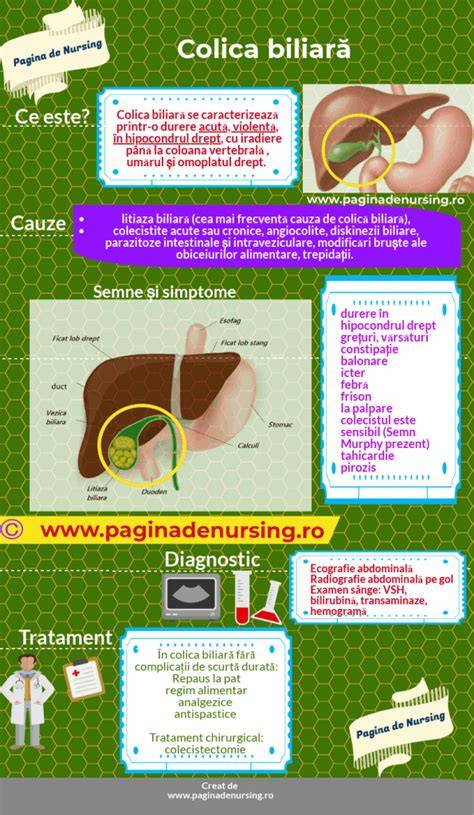 Infografic: schema procesului patologic în colica biliară (litiaza biliară, obstrucția ductelor, inflamația vezicii)