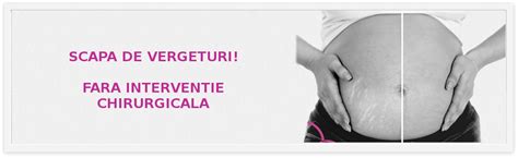 Infografic: Zonele predispuse vergeturi during pregnancy
