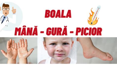 Copil mic cu pete albe in gura