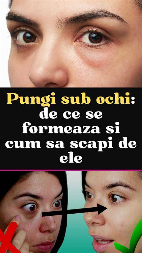 Infografic: Cauzele cearcănelor și cum se formează umbrele sub ochi