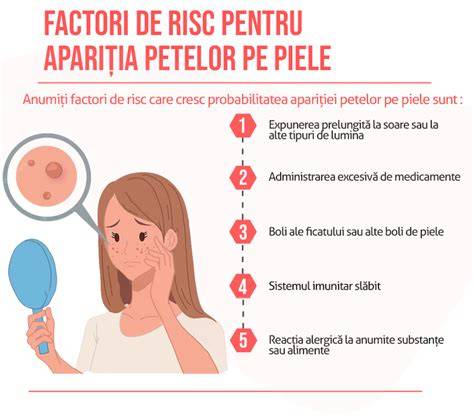 Infografic: tipuri comune de pete pe pielea copiilor și sindroame genetice asociate