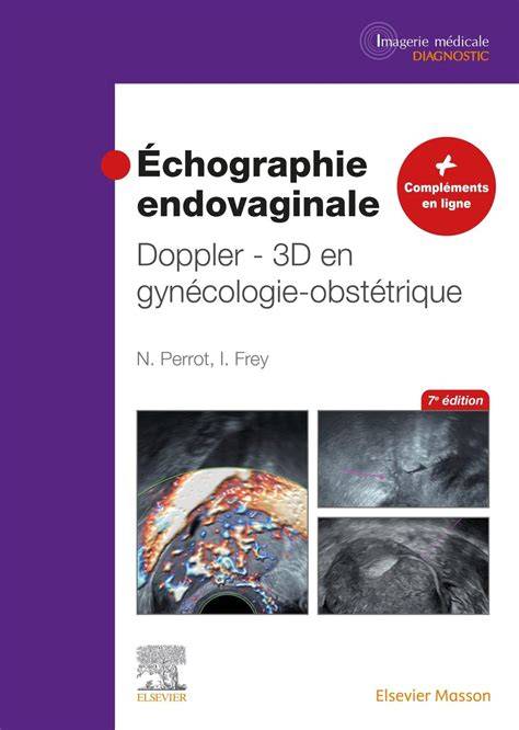 Diagrama comentată a eficientei ecografiei endovaginale 4D Doppler