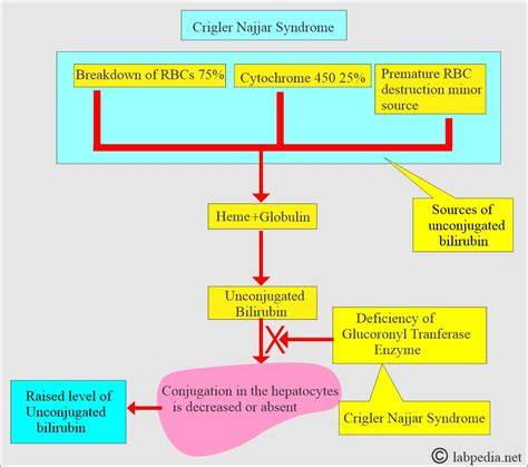 Diagrame despre sindroamele Gilbert, Dublin-Johnson, Crigler-Najjar