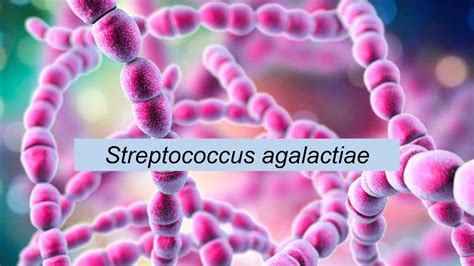 Diagramă a transmiterii Streptococcus agalactiae de la mamă la copil în timpul nașterii