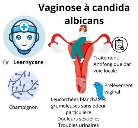 Imagine ilustrând mecanismele Candida albicans în vagin și modul de administrare al ovulelor Macmiror Complex