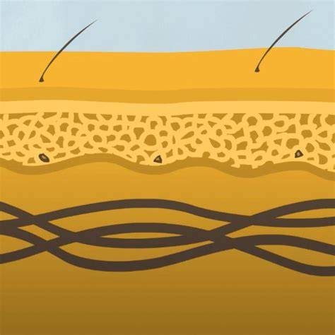 Diagramă a schimbărilor pielii în sarcină: melasma, vergeturi, telangiectazii