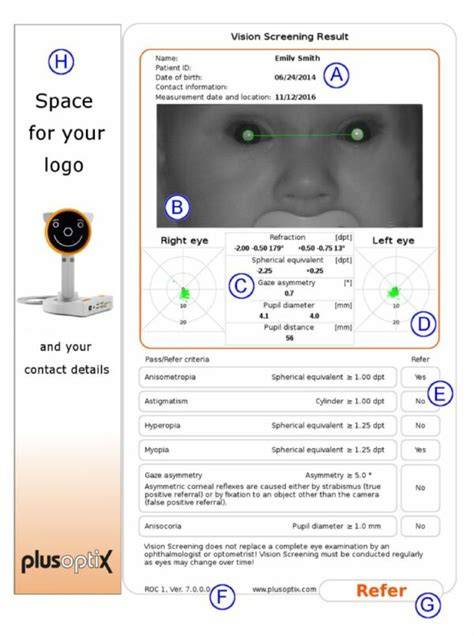 PlusOptix screening copii micuti
