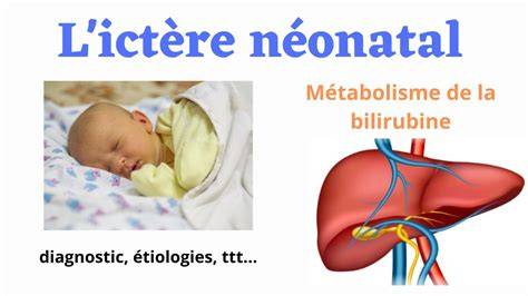 Imagine: diagrame etiologie icter neonatal