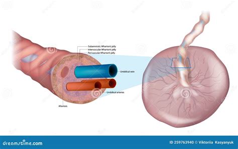Imagine ilustrând anatomia herniei ombilicale la pisică (sac herniar, inel ombilical, conținut)