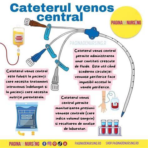 Infografic: Pașii procedurii cateterismului venos central (CVC) și zonele de inserție