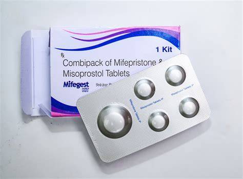 Infografic: pașii avortului medicamentos (consultație, administrare mifepristone, administrare misoprostol, control post-procedură)