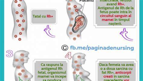 Infografic despre sistemele ABO și Rh și mecanismele izoimunizării în sarcină