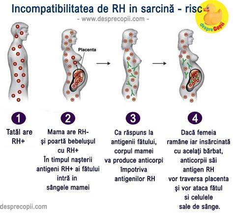 Infografic despre Rh si evolutia sarcinii cu incompatibilitate Rh
