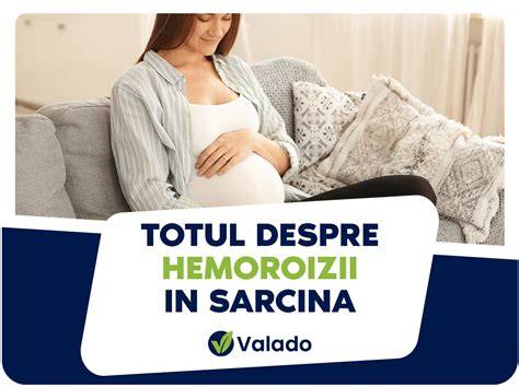Infografic: Cauze hemoroizi in timpul sarcinii