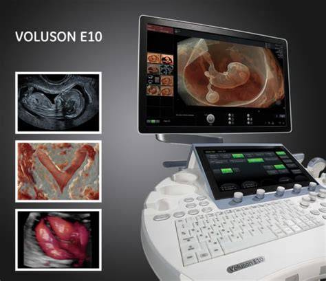 Imaginea echipamentelor de ecografie avansate (GE Voluson E8/E9) utilizate în obstetrică-ginecologie