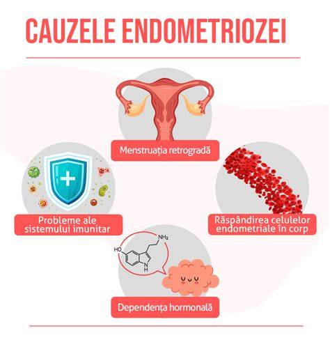 Infografic: Căile de tratament ale endometriozei și decizia privind fertilitatea