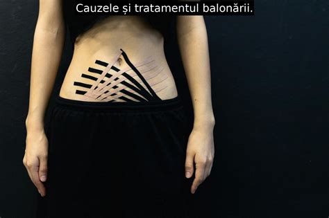 Infografic: Cauzele balonării după cezariană