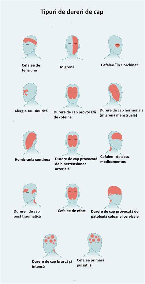 Cauze și tipuri de cefalee în sarcină: primare vs secundare
