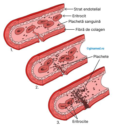 Infografic: etapele formării trombului, de la trombocite la plasmină