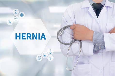 Hernia ombilicală în timpul sarcinii - ilustrație a zonelor afectate