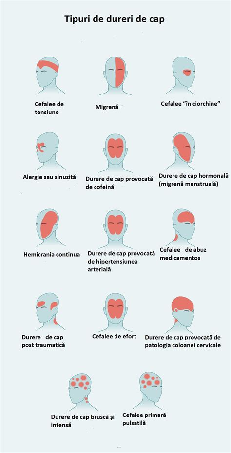 Diagramă: Tipuri de dureri de cap în sarcină