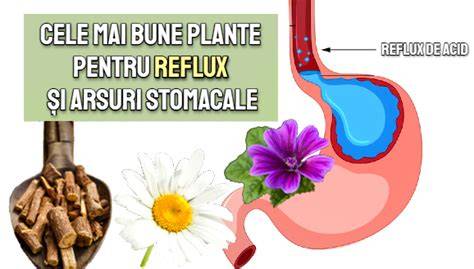 Imaginea procedurilor de diagnostic pentru reflux