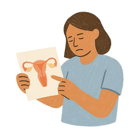 Ilustrație: trasee ale trompelor uterine înainte și după ligaturare