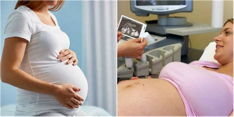 Femeie insarcinata la consultatie ginecologica