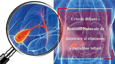 Infografic: procesul de formare a calculilor biliari si mechanismele colicii biliare