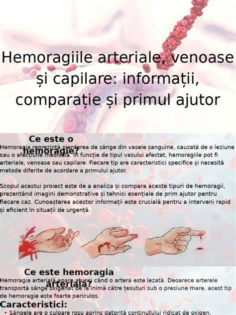 schemă a traseelor arteriale și venoase în rezecția dreptă a colonului