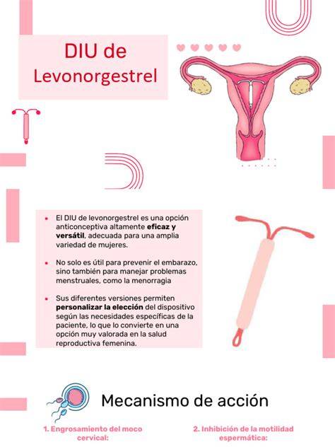 Infografic: cum functioneaza DIU si DIU cu eliberare de levonorgestrel